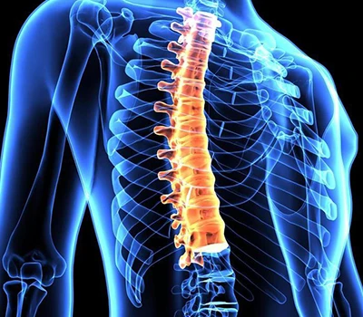 Spinal korrekció: Hogyan alakítja a Xianku3d Body Scanner a gerinc egészségügyi ellátását
